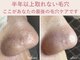 エアル(earu.)の写真