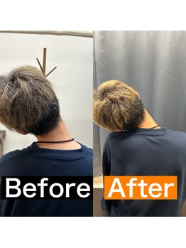 カラダ改善プロジェクト/首肩の施術のビフォーアフター