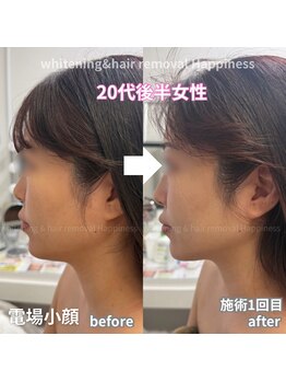 ハピネス 心斎橋アメリカ村本店(Happiness)/20代後半女性