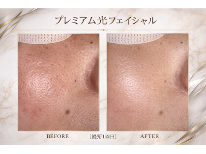 リボーン(RE BORN)の写真