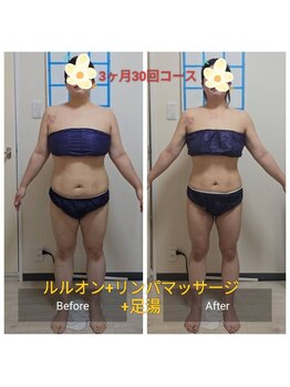 ヨサパーク マグリング(YOSA PARK Magring)/ビフォー&アフター