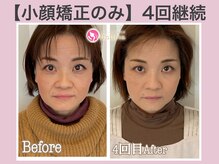 アンリエッタ(Unlieta)/【お顔全体の変化】