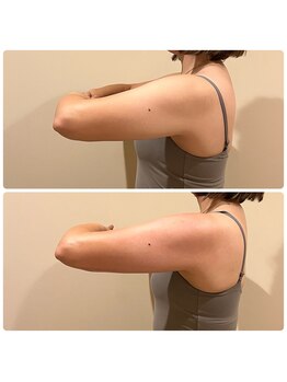 ドゥ ボーテ(de beaute)/最新マシーン導入!