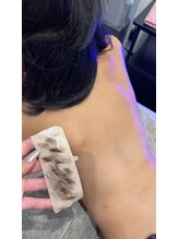 ミヤビ 竹ノ塚店(MIYA美)/キッズ脱毛