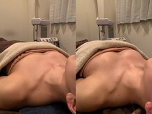 ジェイオー(J.O)/バストアップコルギ/小顔コルギ