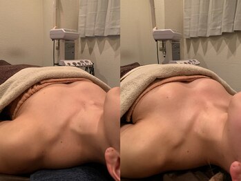 ジェイオー(J.O)/バストアップコルギ/小顔コルギ