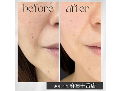 スリール 麻布十番(sourire)の写真