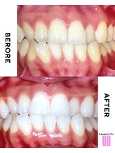 エクシアホワイトニング 王寺店/