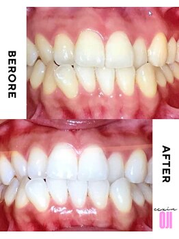 エクシアホワイトニング 王寺店/