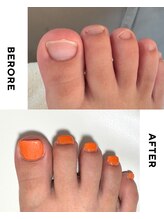 リミズネイルビューティー 名駅店(RimisNailxbeauty)/【美爪育成】《フット》深爪改善