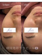 ユフラ(Juhla)/ララピール