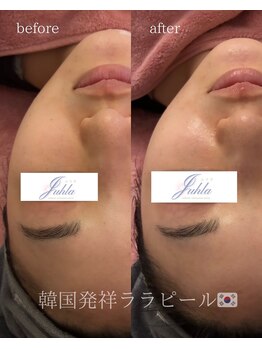 ユフラ(Juhla)/ララピール