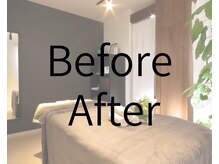 美活ラボ(美活LABO)/ビフォーアフター