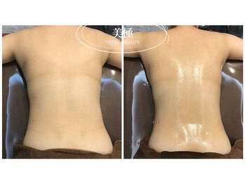 美極 トータルビューティー(美極 TOTAL BEAUTY)/恵比寿/痩身エステ