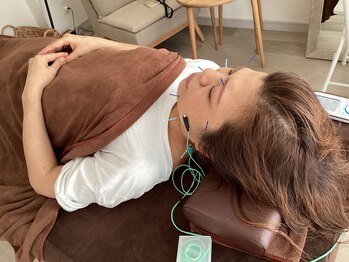 ハリファ鍼灸院 横浜関内院(HariFa鍼灸院)/美容施術