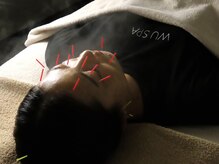 ウースパ(WU SPA)の雰囲気（体の調子も同時に調える小顔美容鍼は即効性◎持続性◎）