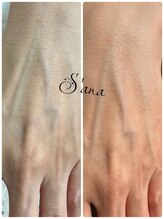 サナ 久が原 千鳥町(S’ana)/ハーブピーリング