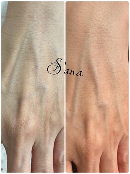 サナ 久が原 千鳥町(S’ana)/ハーブピーリング