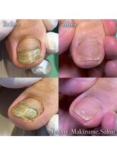 巻き爪補正店 那覇店/