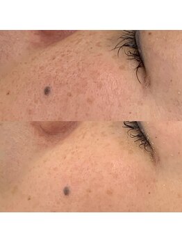 酵素浴サロン アールアール(R2)/