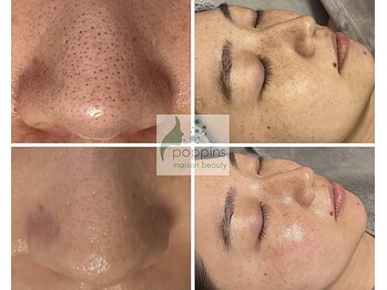 メゾンビューティーポピンズ 恵比寿(maisonbeauty poppins)