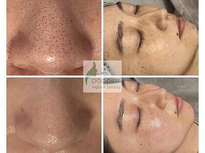 メゾンビューティーポピンズ 恵比寿(maisonbeauty poppins)の写真