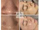 メゾンビューティーポピンズ 恵比寿(maisonbeauty poppins)の写真