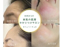 トリートメントルーム フェリーチェ(Felice)