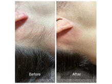 エルモア(L-MORE)の雰囲気（1回でもわかる。結果に高評価！！【脱毛/光脱毛/都度払いあり】）