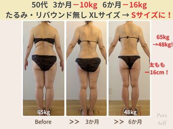 ピュアセルフ 新浦安(Pure Self)/【ビフォーアフター】