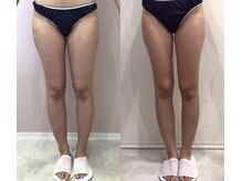 リラパドマ 千葉店(Rela Padma)/激痩せ短期集中ダイエットコース