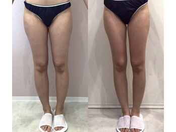 リラパドマ 千葉店(Rela Padma)/激痩せ短期集中ダイエットコース