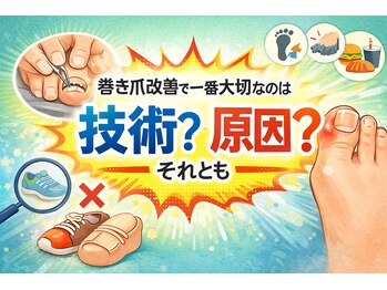 巻き爪じゅん 千葉駅前店/巻き爪改善で大切なのは技術？