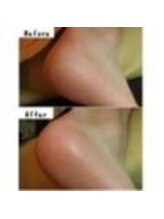 日本巻き爪センター 渋谷院