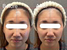 ヘレフア(Hele Hua)の雰囲気（結果重視！3方向からアプローチする”造顔フェイシャル”）