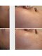 ビューティスト(Beautist)の写真/憧れの素肌へ！肌トラブルやニキビケアに寄り添います！自信あふれる素肌作りを目指しましょう◎