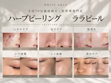 ホワイトアクア 鳳店(WHITE AQUA)の雰囲気（年間15,000名以上の症例を元にお肌悩みに合わせて徹底サポート♪）