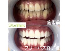 ルブラン 奈良店(Le Blanc)/美容習慣始めませんか？
