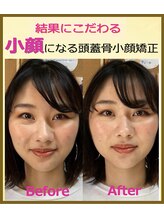 てぃ～だ/肌艶小顔に☆【王子駅/整体】