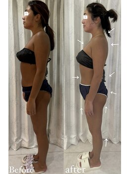 ミミルーチェ(mimiluce)/若よもぎ蒸し回数券