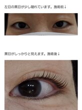 アロマスイーツ(AromaSweets)/まつげパーマ/まつ毛パーマ