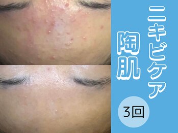 ポラリス(Polaris)/