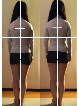 クーラクー(Coeur a Coeur)/巻き肩・肩こり・美姿勢