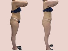 シェリートーキョー 成田店(Cherie Tokyo)/Before＆After /成田店