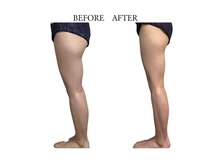 ヨサパーク サノン(YOSA PARK Sanon)/憧れの美脚、なりましょう！