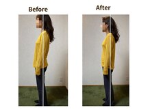 フェルナ(FERNA)/Before/After