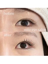 ミテ(mite)/新技術【アンドヘルシー】