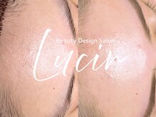 ルシール 仙台店(lucir)/<WAX> Before/After