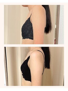 ワム(Wom)/バストアップ3ヶ月/育乳/20代