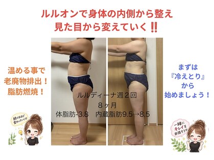 ヨサパーク ポミエ(YOSA PARK Pommier)の写真